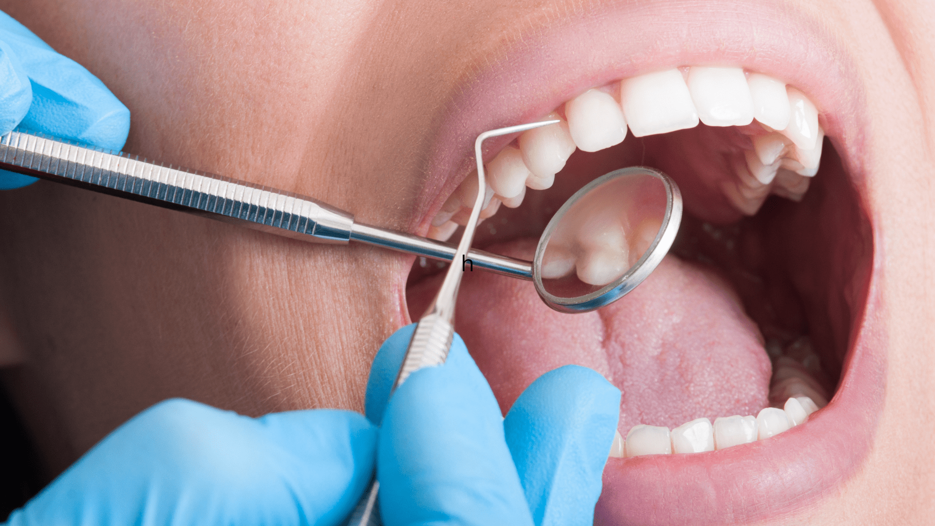 Paducah Dentist Offices - teeth cleaning